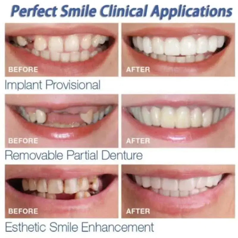 Snap On Fake Teeth - Easy Application for Instant Smile Transformation (1 Pc)