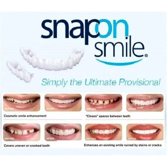 Snap On Fake Teeth - Easy Application for Instant Smile Transformation (1 Pc)